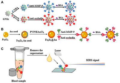 Rapid magnetic separation: An immunoassay platform for the SERS-based detection of subarachnoid hemorrhage biomarkers